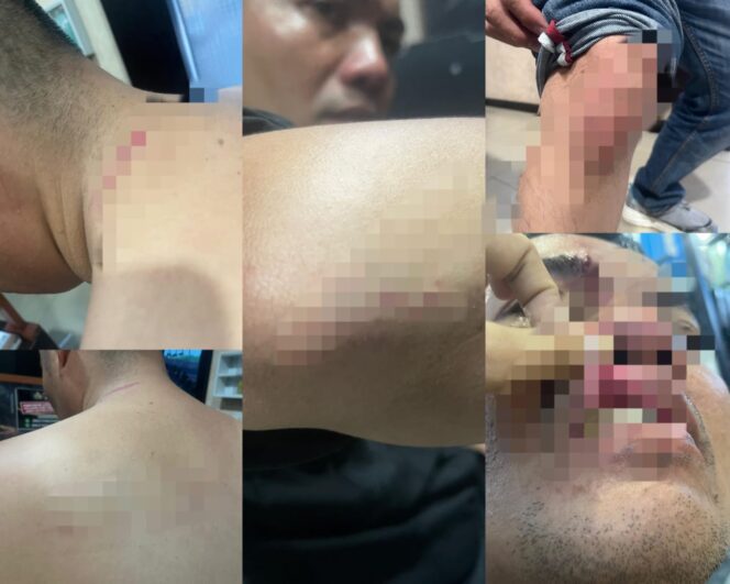 
					Korban mengalami luka fisik dan tekanan psikologis akibat pengeroyokan